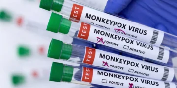 En México no se ha encontrado ningún caso de la nueva variante de la viruela del mono