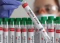 México está entre los diez países más afectados por Mpox, según la DGE