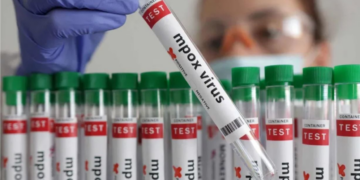 México está entre los diez países más afectados por Mpox, según la DGE