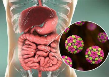 ¿Qué es la norovirus, cuáles son sus síntomas y cómo se contagia?