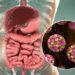 ¿Qué es la norovirus, cuáles son sus síntomas y cómo se contagia?