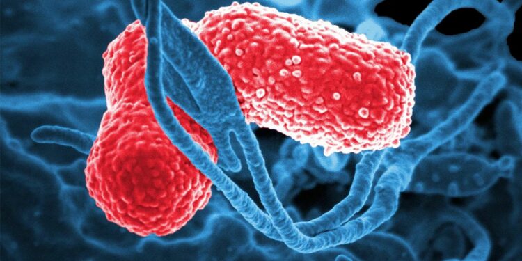 Fallecieron 17 menores por bacteria Klebsiella oxytoca; brote está controlado, asegura SSa