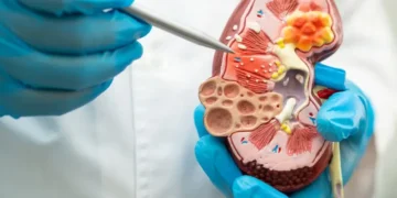Avances en la lucha contra el cáncer de riñón avanzado gracias a vacuna experimental
