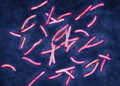 El problema sobre superbacterias que tomó años para ser resuelto por los científicos y que la IA solucionó en dos días