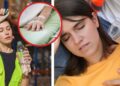 ¿Dolor de cabeza y debilidad por sol? Podría ser agotamiento por calor: qué hacer