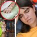 ¿Dolor de cabeza y debilidad por sol? Podría ser agotamiento por calor: qué hacer