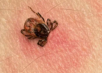 Lyme, la terrible enfermedad que tiene Justin Timberlake y cómo afecta a la salud