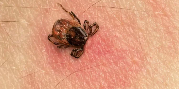 Lyme, la terrible enfermedad que tiene Justin Timberlake y cómo afecta a la salud