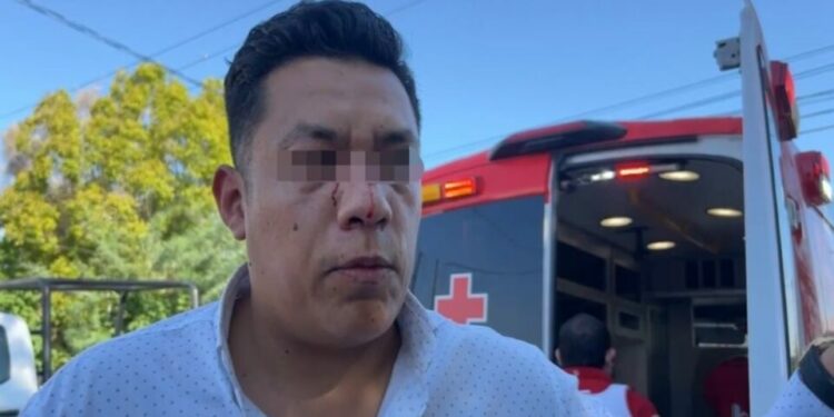 Atacan a golpes a periodista en Mexicali, Baja California