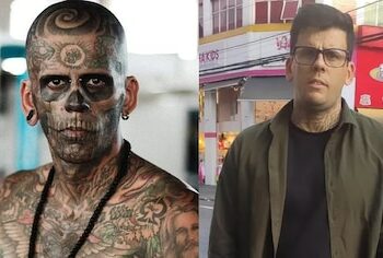 Se hizo una cirugía para quitarse todos sus tatuajes.