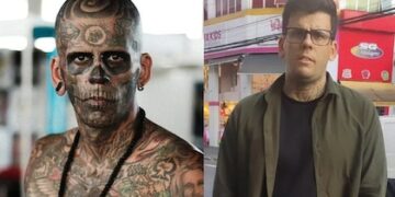 Se hizo una cirugía para quitarse todos sus tatuajes.