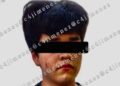 Menor de 13 años que disparó en la cara a su mamá por castigarlo, en Polanco, es liberado