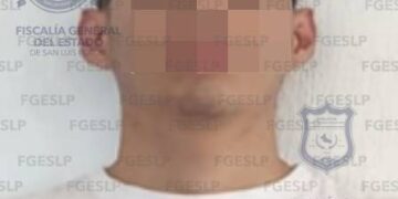 Detienen a Oswaldo “N” por intento de feminicidio en Ciudad Fernández