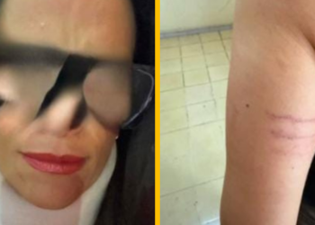 Denuncian a médica del IMSS por golpear a enfermera