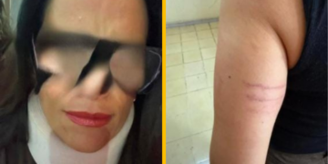 Denuncian a médica del IMSS por golpear a enfermera
