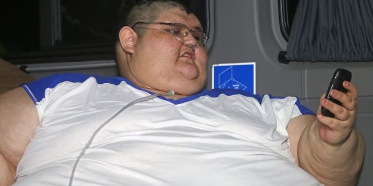 Muere Juan Pedro Franco, mexicano conocido por haber sido el hombre más obeso del mundo