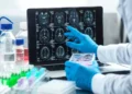 Científicos descubren fármaco que podría detener la muerte neuronal por Alzheimer