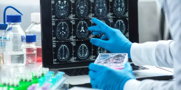 Científicos descubren fármaco que podría detener la muerte neuronal por Alzheimer