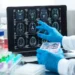Científicos descubren fármaco que podría detener la muerte neuronal por Alzheimer
