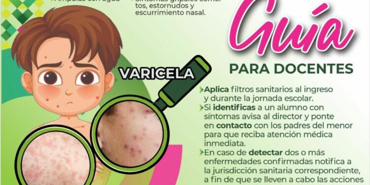 Refuerzan medidas de prevención por varicela y sarampión en escuelas