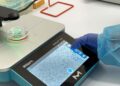 Un estudio con pacientes mexicanos revela detalles inéditos del melanoma acral, el subtipo de cáncer de piel más común en Latinoamérica