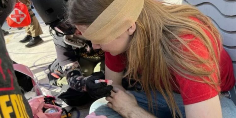 Estudiante pierde ojo tras ser alcanzado por proyectil disparado por un agente federal durante protesta en Los Ángeles