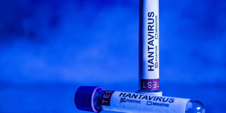 Mujer que dio positivo por hantavirus está en cuidados intensivos; es el primer caso relacionado con el brote en Francia