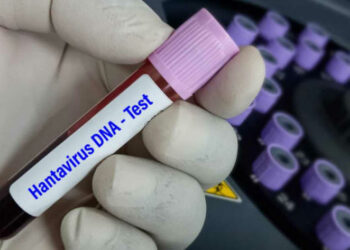 Medio israelí reporta primer caso de hantavirus en el país; no está ligado al crucero MV Hondius