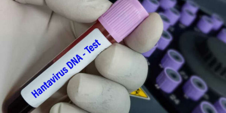 Medio israelí reporta primer caso de hantavirus en el país; no está ligado al crucero MV Hondius