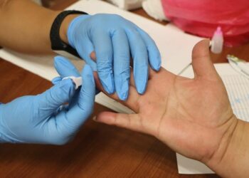 Reporta Salud control de casos de VIH en SLP