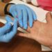 Reporta Salud control de casos de VIH en SLP