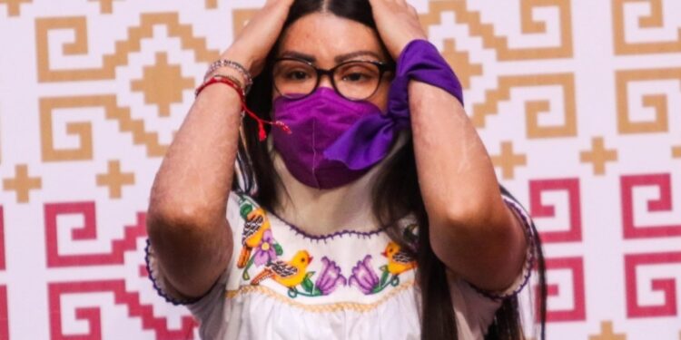 SCJN rechaza revisar caso de ataque con ácido contra la saxofonista María Elena Ríos