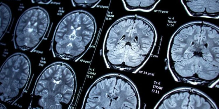 Convulsiones febriles: señales de alerta y primeros pasos para ayudar a tu hijo