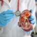Día Mundial del Cáncer de Riñón: la importancia de cuidar un órgano clave para la salud