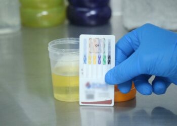 Temazcalli realiza más de 15 mil estudios toxicológicos en primeros meses de 2026