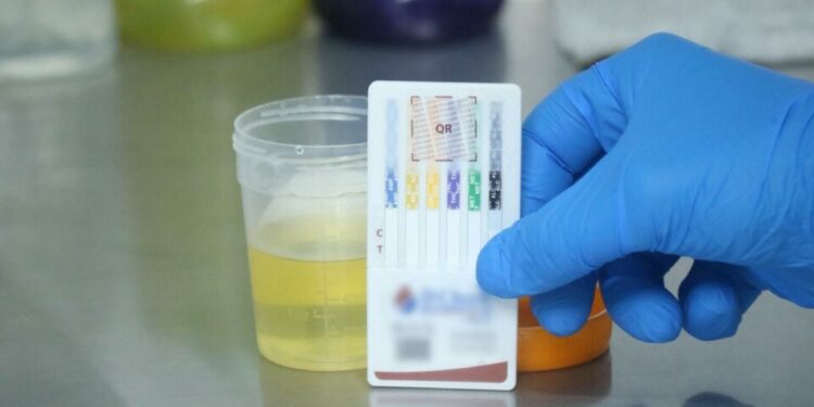 Temazcalli realiza más de 15 mil estudios toxicológicos en primeros meses de 2026