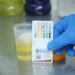 Temazcalli realiza más de 15 mil estudios toxicológicos en primeros meses de 2026