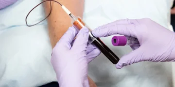 Lo que debes saber sobre la nueva y potente píldora para el colesterol