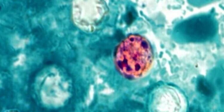 Casos de ciclosporiasis aumentan en Estados Unidos; ¿Qué es, cuáles son sus síntomas y cómo prevenirla?