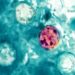 Casos de ciclosporiasis aumentan en Estados Unidos; ¿Qué es, cuáles son sus síntomas y cómo prevenirla?