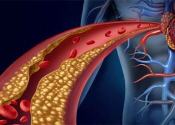 Los 6 alimentos que pueden aumentar más el colesterol, según cardiólogos y nutricionistas