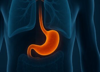 Cuáles son las comidas que favorecen la acidez estomacal y claves prevenirla