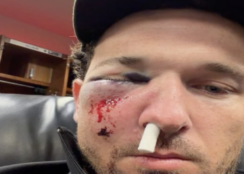 Accidente en Grandes Ligas: pelotazo manda al hospital a Alex Bregman