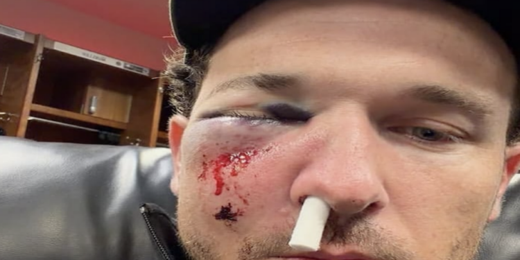 Accidente en Grandes Ligas: pelotazo manda al hospital a Alex Bregman