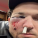 Accidente en Grandes Ligas: pelotazo manda al hospital a Alex Bregman