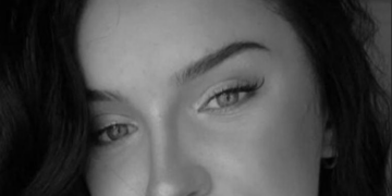 Reina de belleza Miss Austria pierde la vida luego de someterse a 7 operaciones
