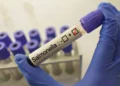 Salud confirma brote de salmonela en Hospital General de México; hay 135 afectados