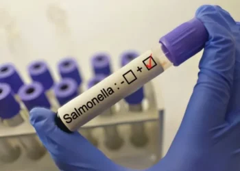 Salud confirma brote de salmonela en Hospital General de México; hay 135 afectados