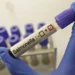 Salud confirma brote de salmonela en Hospital General de México; hay 135 afectados