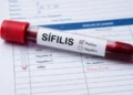 Sífilis en jóvenes: los diagnósticos crecieron casi un 25% entre 2024 y 2025
